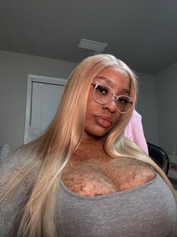 freckledn