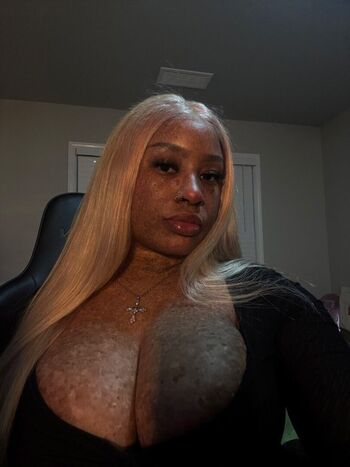 freckledn