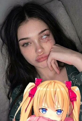 miascarmia
