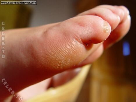 Scandinavian Feet