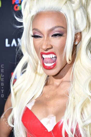 Winnie Harlow