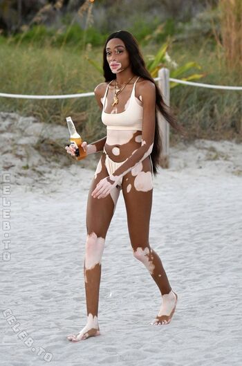 Winnie Harlow