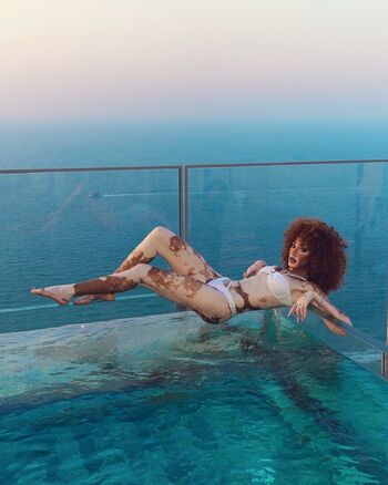 Winnie Harlow