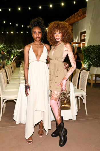 Winnie Harlow